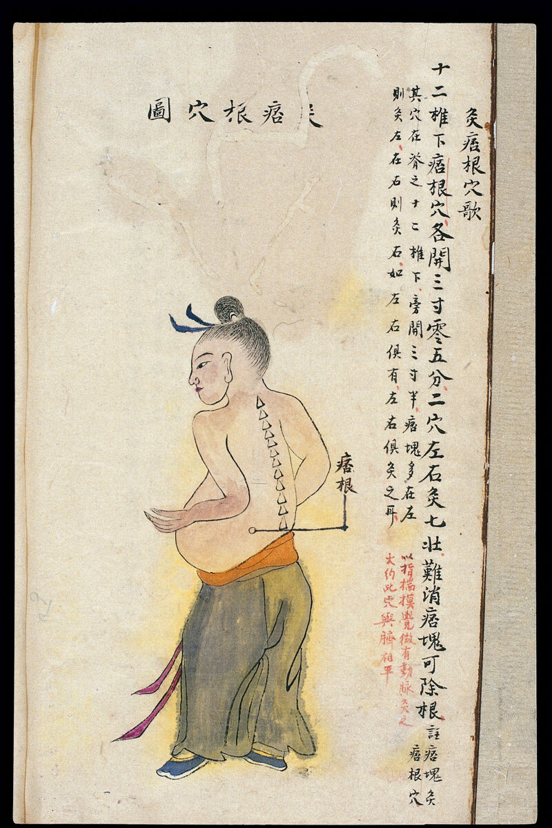 气虚阳虚吃什么中药